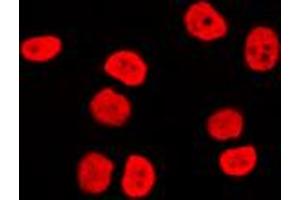 Immunofluorescent analysis of BAF170 staining in Raji cells. (SMARCC2 antibody  (Center))