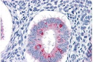 Human Uterus: Formalin-Fixed, Paraffin-Embedded (FFPE) (TFF3 antibody  (AA 15-74))