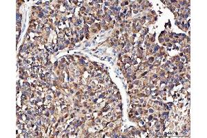 IHC analysis of Angiogenin/ANG using anti-Angiogenin/ANG antibody (ABIN4886457).