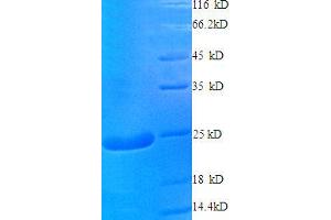 CSRP2 Protein (AA 2-193, full length) (His tag)