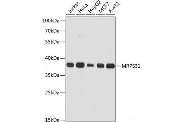 MRPS31 antibody