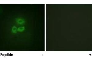 Immunofluorescence analysis of A-549 cells, using PRKD1 polyclonal antibody . (PKC mu antibody  (Ser205))