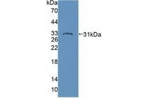 Detection of Recombinant PTPN22, Human using Polyclonal Antibody to Protein Tyrosine Phosphatase, Non Receptor Type 22 (PTPN22) (PTPN22 antibody  (AA 1-233))