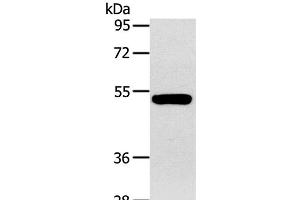 Western Blot analysis of Human fetal muscle tissue using GJA9 Polyclonal Antibody at dilution of 1:400 (GJA9 antibody)