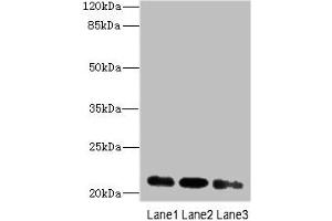 Western blot All lanes: MRPL11 antibody at 16 μg/mL Lane 1: HepG2 whole cell lysate Lane 2: Hela whole cell lysate Lane 3: A549 whole cell lysate Secondary Goat polyclonal to rabbit IgG at 1/10000 dilution Predicted band size: 21, 19, 20 kDa Observed band size: 21 kDa (MRPL11 antibody  (AA 1-191))