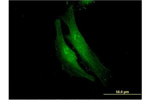 FANCF antibody  (AA 1-91)