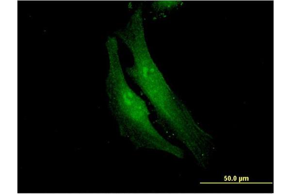 FANCF antibody  (AA 1-91)