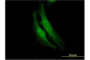 Immunofluorescence of monoclonal antibody to FANCF on HeLa cell.