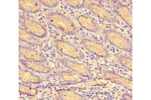 Immunohistochemistry of paraffin-embedded human small intestine tissue using ABIN7146019 at dilution of 1:100 (CCL8 antibody  (AA 24-99))