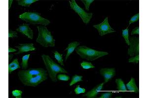 Immunofluorescence of purified MaxPab antibody to ITGAX on HeLa cell. (CD11c antibody  (AA 1-1169))