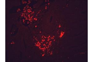 Immunohistochemistry (IHC) image for anti-Heat Shock Protein 90 (HSP90) antibody (ABIN361718)