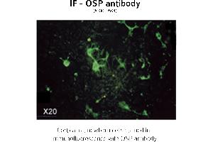 Image no. 3 for anti-Claudin 11 (CLDN11) (C-Term) antibody (ABIN346949) (Claudin 11 antibody  (C-Term))