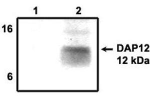 Immunoprecipitation using DAP12  antibody on MHC class I (1) and  NKp44 (2) positive cells. (TYROBP antibody  (Cytoplasmic Domain))