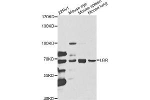 Western blot analysis of extracts of various cell lines, using LBR antibody (ABIN1876656) at 1:1000 dilution. (Lamin B Receptor antibody)