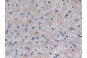 Detection of HSPb7 in Human Liver Tissue using Polyclonal Antibody to Heat Shock Protein Beta 7 (HSPb7) (HSPB7 antibody  (AA 1-170))