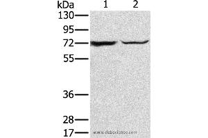 Western blot analysis of Mouse liver tissue and hepg2 cell, using SLC25A13 Polyclonal Antibody at dilution of 1:450 (slc25a13 antibody)