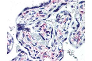 Anti-IL1R1 antibody IHC of human placenta. (IL1R1 antibody  (Extracellular Domain))
