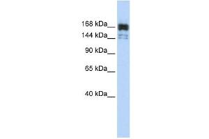 XRN1 antibody used at 1 ug/ml to detect target protein. (XRN1 antibody  (Middle Region))