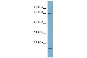 Plastin 3 antibody used at 1 ug/ml to detect target protein. (Plastin 3 antibody)