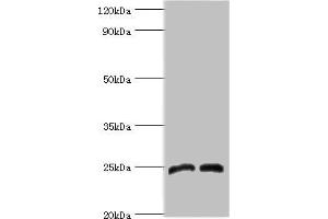 Western blot All lanes: Dickkopf-related protein 4 antibody at 8 μg/mL Lane 1: Jurkat whole cell lysate Lane 2: K562 whole cell lysate Secondary Goat polyclonal to rabbit IgG at 1/10000 dilution Predicted band size: 25 kDa Observed band size: 25 kDa