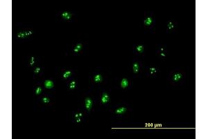 Immunofluorescence of purified MaxPab antibody to DDX18 on HeLa cell. (DDX18 antibody  (AA 1-670))