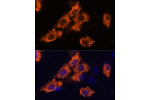 Immunofluorescence analysis of C6 cells using SEMA antibody (ABIN7270199) at dilution of 1:100. (Sema4a antibody  (AA 320-580))