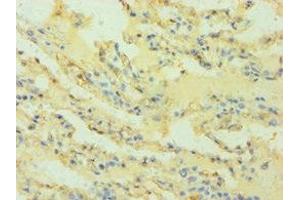 Immunohistochemistry of paraffin-embedded human lung tissue using ABIN7155546 at dilution of 1:100 (HLAG antibody  (AA 20-230))