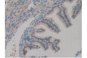 IHC-P analysis of Mouse Ovary Tissue, with DAB staining. (TICAM1 antibody  (AA 263-526))