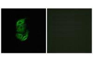 Immunofluorescence analysis of A549 cells, using STA13 antibody.