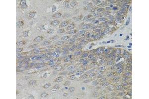 Immunohistochemistry of paraffin-embedded Human esophagus using SLC30A1 Polyclonal Antibody (SLC30A1 antibody)