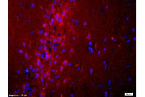 Formalin-fixed and paraffin-embedded rat brain labeled with Anti ADCY10 Polyclonal Antibody, Unconjugated (ABIN751093) 1:200, overnight at 4°C, The secondary antibody was Goat Anti-Rabbit IgG, Cy3 conjugated used at 1:200 dilution for 40 minutes at 37°C.