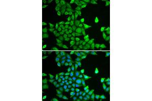Immunofluorescence analysis of MCF-7 cell using PSMA6 antibody. (PSMA6 antibody  (AA 1-246))