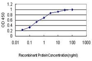 Detection limit for recombinant GST tagged EWSR1 is approximately 0. (EWSR1 antibody  (AA 358-453))