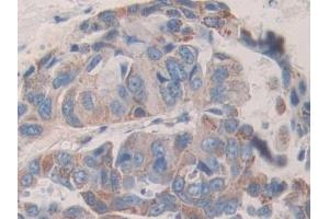 Used in DAB staining on fromalin fixed paraffin- embedded stomach tissue (KIR2DL2 antibody  (AA 22-348))