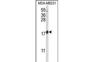 Western blot analysis of HRIHF Antibody (C-term) (ABIN653093 and ABIN2842686) in MDA-M cell line lysates (35 μg/lane). (CBY1/PGEA1 antibody  (C-Term))