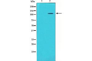 Western blot analysis on mouse brain lysate using GluR5 Antibody,The lane on the left is treated with the antigen-specific peptide. (GRIK1 antibody  (Internal Region))