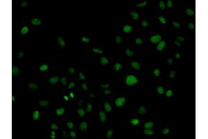 Immunofluorescence analysis of HeLa cells using PLCG2 antibody (ABIN5971208). (Phospholipase C gamma 2 antibody)