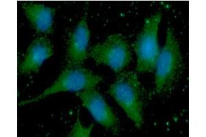 ICC/IF analysis of S100A11 in A549 cells line, stained with DAPI (Blue) for nucleus staining and monoclonal anti-human S100A11 antibody (1:100) with goat anti-mouse IgG-Alexa fluor 488 conjugate (Green). (S100A11 antibody  (AA 1-105))