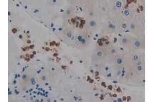 Detection of PTPRQ in Human Liver Tissue using Polyclonal Antibody to Protein Tyrosine Phosphatase Receptor Type Q (PTPRQ)