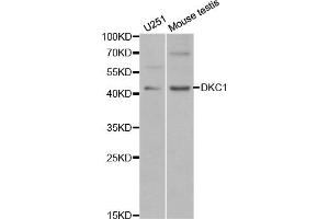 Western blot analysis of extracts of various cell lines, using DKC1 antibody (ABIN5970956) at 1/1000 dilution.