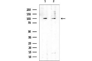 anti-HEAT Repeat Containing 2 (HEATR2) (Internal Region) antibody