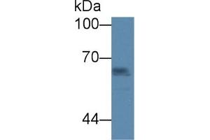 Detection of ICAM1 in Human Raji cell lysate using Polyclonal Antibody to Intercellular Adhesion Molecule 1 (ICAM1) (ICAM1 antibody  (AA 25-531))