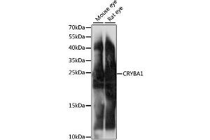 Western blot analysis of extracts of various cell lines, using CRYBA1 antibody (ABIN6291831) at 1:1000 dilution. (CRYBA1 antibody)