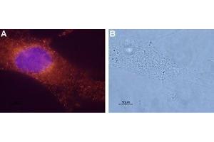 Expression of Bombesin receptor 1 in a human breast cancer cell line - Immunocytochemical staining of paraformaldehyde-fixed and permeabilized mammary gland adenocarcinoma MDA-MB-231. (NMBR antibody  (3rd Intracellular Loop))