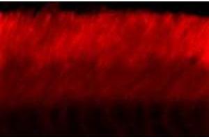 Immunofluorescence (IF) image for anti-ATP-Binding Cassette, Sub-Family A (ABC1), Member 4 (ABCA4) antibody (ABIN371821) (ABCA4 antibody)