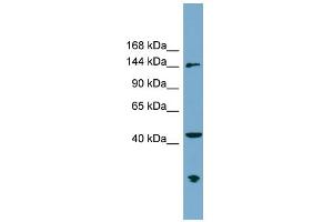 WB Suggested Anti-ERCC6L Antibody Titration: 0. (ERCC6L antibody  (N-Term))