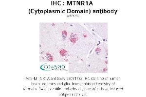 Image no. 1 for anti-Melatonin Receptor 1A (MTNR1A) (1st Cytoplasmic Domain) antibody (ABIN1737115)