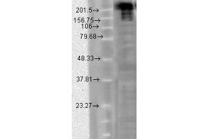 Image no. 1 for anti-Sodium Channel, Voltage-Gated, Type IX, alpha Subunit (SCN9A) (AA 1751-1946) antibody (ABIN466986) (SCN9A antibody  (AA 1751-1946))