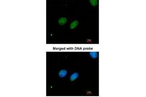 ICC/IF Image Immunofluorescence analysis of paraformaldehyde-fixed HeLa, using XRCC4, antibody at 1:200 dilution. (XRCC4 antibody  (C-Term))