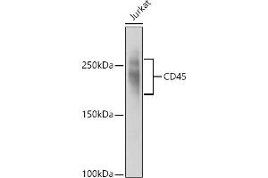 Western Blotting (WB) image for anti-Protein tyrosine Phosphatase, Receptor Type, C (PTPRC) (AA 890-990) antibody (ABIN3022954)